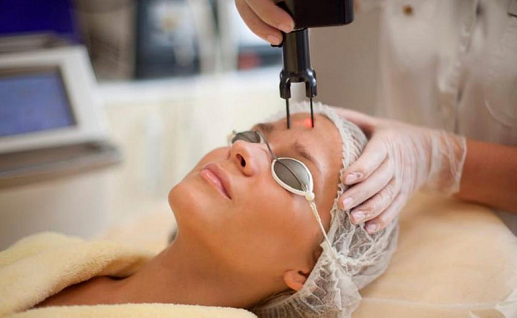 Лазерная шлифовка